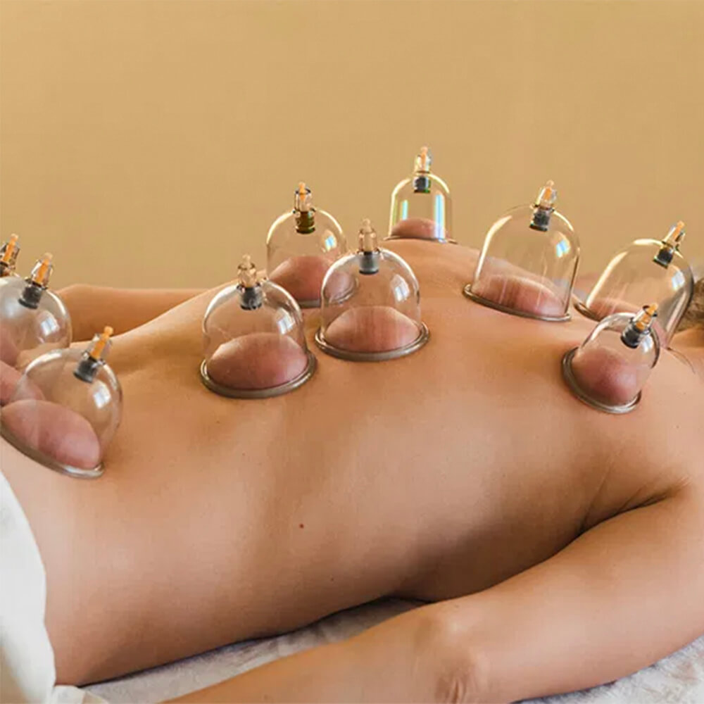 Beyond Back Pain: Uncovering the Diverse Benefits of Cupping Therapy