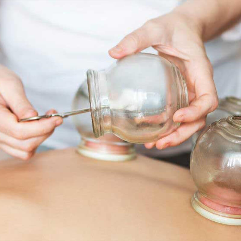 From Athletes to Desk Jockeys: Who Can Benefit from Cupping Massage?